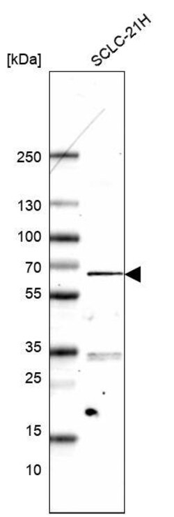 ETV1 Antibody (CL15251) - Azide and BSA Free, Novus Biologicals 100 ul;
