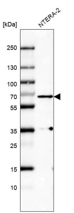 PLK1 Antibody (CL8360) - Azide and BSA Free, Novus Biologicals 100 ul;