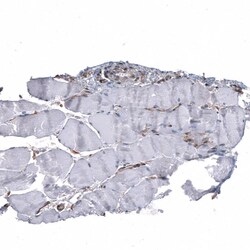 PTEN Antibody (CL11723) - Azide and BSA Free, Novus Biologicals 100 ul;