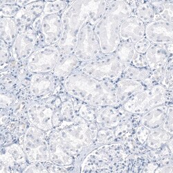 AGER Antibody (CL10591) - Azide and BSA Free, Novus Biologicals 100 ul;