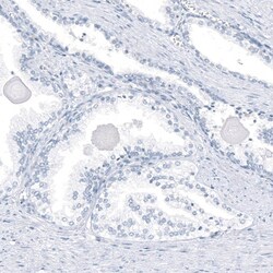 AGER Antibody (CL10591) - Azide and BSA Free, Novus Biologicals 100 ul;