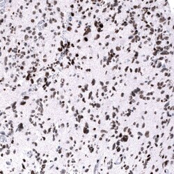 EZH2/KMT6 Antibody (CL11945) - Azide and BSA Free, Novus Biologicals 100