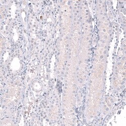 EZH2/KMT6 Antibody (CL11945) - Azide and BSA Free, Novus Biologicals 100