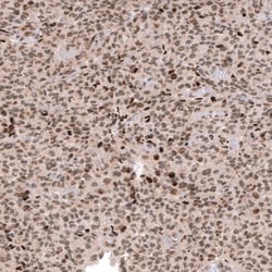 EZH2/KMT6 Antibody (CL11945) - Azide and BSA Free, Novus Biologicals 100