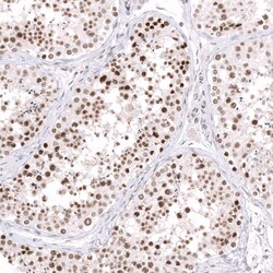 EZH2/KMT6 Antibody (CL11945) - Azide and BSA Free, Novus Biologicals 100