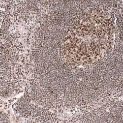 EZH2/KMT6 Antibody (CL11945) - Azide and BSA Free, Novus Biologicals 100