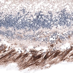 ABCB5 Antibody (CL13618) - Azide and BSA Free, Novus Biologicals 100 ul;