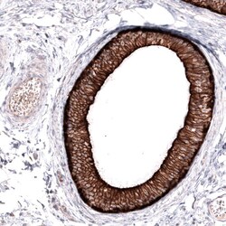 ABCB5 Antibody (CL13618) - Azide and BSA Free, Novus Biologicals 100 ul;