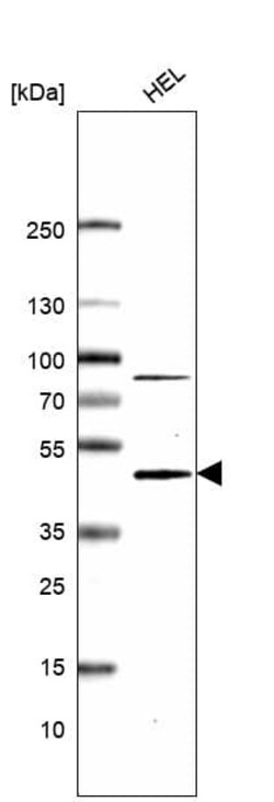 TYKi Antibody (CL14486) - Azide and BSA Free, Novus Biologicals 100 ul;