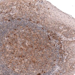 Porimin Antibody (CL14381) - Azide and BSA Free, Novus Biologicals 100