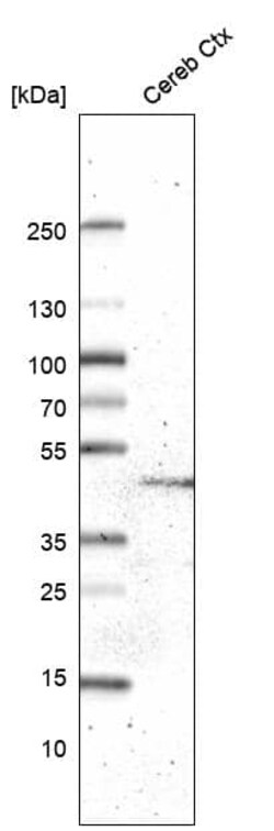 GPR88 Antibody (CL15190) - Azide and BSA Free, Novus Biologicals 100 ul;