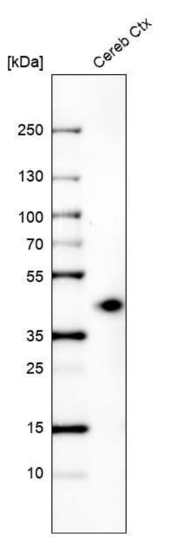 beta-1,3-Glucuronyltransferase 1/B3GAT1 Antibody (CL9499) - Azide and BSA