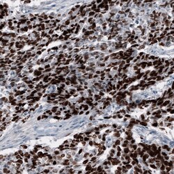 SALL4 Antibody (CL12180) - Azide and BSA Free, Novus Biologicals 100 ul;