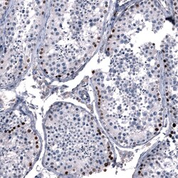 SALL4 Antibody (CL12180) - Azide and BSA Free, Novus Biologicals 100 ul;