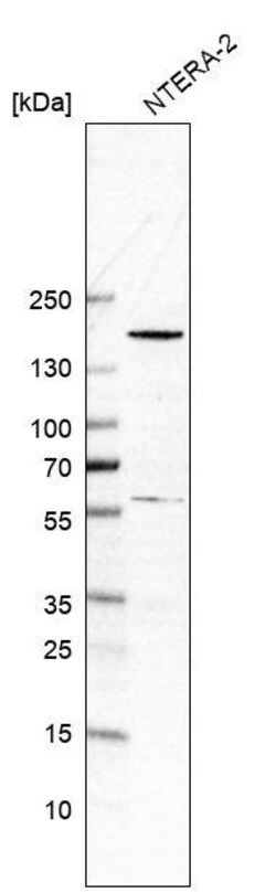 SALL4 Antibody (CL12180) - Azide and BSA Free, Novus Biologicals 100 ul;