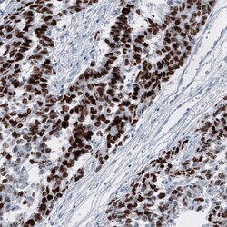 SALL4 Antibody (CL12183) - Azide and BSA Free, Novus Biologicals 100 ul;