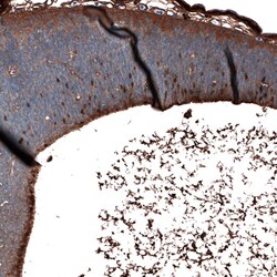 SALL4 Antibody (CL12183) - Azide and BSA Free, Novus Biologicals 100 ul;