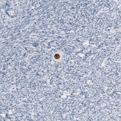 SALL4 Antibody (CL12183) - Azide and BSA Free, Novus Biologicals 100 ul;