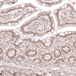 KLF2 Antibody (CL14502) - Azide and BSA Free, Novus Biologicals 100 ul;