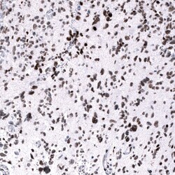 EZH2/KMT6 Antibody (CL11960) - Azide and BSA Free, Novus Biologicals 100