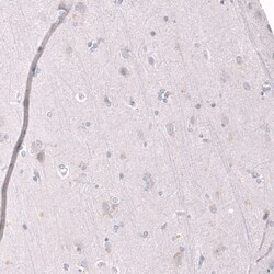 EZH2/KMT6 Antibody (CL11960) - Azide and BSA Free, Novus Biologicals 100