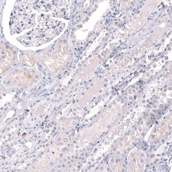 EZH2/KMT6 Antibody (CL11960) - Azide and BSA Free, Novus Biologicals 100