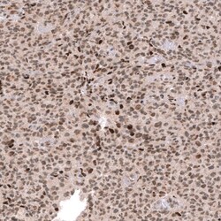 EZH2/KMT6 Antibody (CL11960) - Azide and BSA Free, Novus Biologicals 100