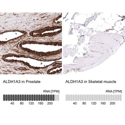 ALDH1A3 Antibody (CL11968) - Azide and BSA Free, Novus Biologicals 100