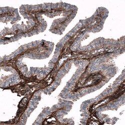 Periostin/OSF-2 Antibody (CL12087) - Azide and BSA Free, Novus Biologicals