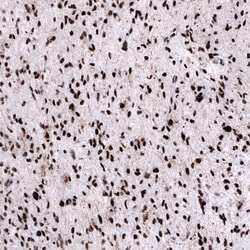 FoxM1 Antibody (CL12131) - Azide and BSA Free, Novus Biologicals 100 ul;