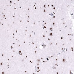 FoxM1 Antibody (CL12131) - Azide and BSA Free, Novus Biologicals 100 ul;