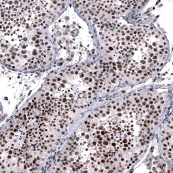 FoxM1 Antibody (CL12131) - Azide and BSA Free, Novus Biologicals 100 ul;