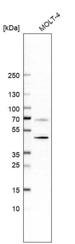 CD5 Antibody (CL12334) - Azide and BSA Free, Novus Biologicals 100 ul;