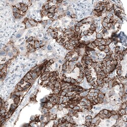 Claudin-3 Antibody (CL13129) - Azide and BSA Free, Novus Biologicals 100