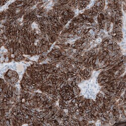 Claudin-3 Antibody (CL13128) - Azide and BSA Free, Novus Biologicals 100