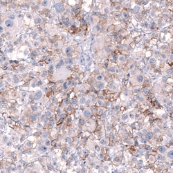 NCAM-1/CD56 Antibody (CL12732) - Azide and BSA Free, Novus Biologicals