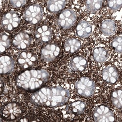 CD44 Antibody (CL13319) - Azide and BSA Free, Novus Biologicals 100 &mu;L | Buy Online | Novus Biologicals | Fisher Scientific