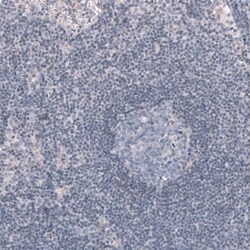 WT1 Antibody (CL13170) - Azide and BSA Free, Novus Biologicals 100 ul;