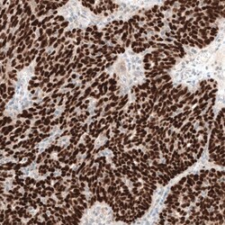 WT1 Antibody (CL13170) - Azide and BSA Free, Novus Biologicals 100 ul;