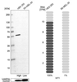 WT1 Antibody (CL13170) - Azide and BSA Free, Novus Biologicals 100 ul;