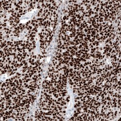 WT1 Antibody (CL13170) - Azide and BSA Free, Novus Biologicals 100 ul;
