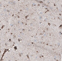 PBR Antibody (CL13358) - Azide and BSA Free, Novus Biologicals 100 ul;
