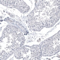 L1CAM Antibody (CL12988) - Azide and BSA Free, Novus Biologicals 100 ul;