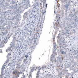 L1CAM Antibody (CL12988) - Azide and BSA Free, Novus Biologicals 100 ul;