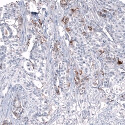 L1CAM Antibody (CL12984) - Azide and BSA Free, Novus Biologicals 100 ul;