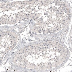 L1CAM Antibody (CL12984) - Azide and BSA Free, Novus Biologicals 100 ul;
