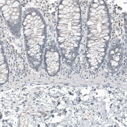 FOXL2 Antibody (CL12753) - Azide and BSA Free, Novus Biologicals 100 ul;