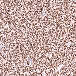 FOXL2 Antibody (CL12753) - Azide and BSA Free, Novus Biologicals 100 ul;