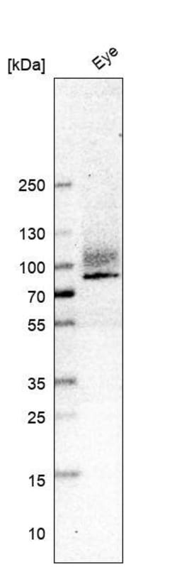 Integrin beta 8 Antibody (CL7290) - Azide and BSA Free, Novus Biologicals