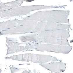 CD47 Antibody (CL6913) - Azide and BSA Free, Novus Biologicals 100 &mu;L | Buy Online | Novus Biologicals | Fisher Scientific